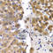 Sterol Carrier Protein 2 antibody, A5382, ABclonal Technology, Immunohistochemistry paraffin image 
