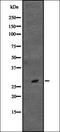 Calbindin 1 antibody, orb336980, Biorbyt, Western Blot image 