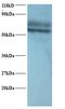 Tyrosyl-TRNA Synthetase antibody, LS-C210970, Lifespan Biosciences, Western Blot image 