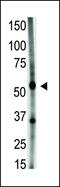 Growth Differentiation Factor 5 antibody, 61-070, ProSci, Western Blot image 