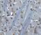 Bruton Tyrosine Kinase antibody, 3395, ProSci Inc, Immunohistochemistry paraffin image 