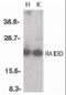 CASP2 And RIPK1 Domain Containing Adaptor With Death Domain antibody, orb87306, Biorbyt, Western Blot image 