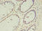 Vasohibin 2 antibody, LS-C371588, Lifespan Biosciences, Immunohistochemistry paraffin image 