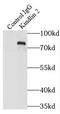 Fermitin Family Member 2 antibody, FNab04576, FineTest, Immunoprecipitation image 