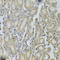 Platelet Derived Growth Factor Subunit B antibody, LS-C331340, Lifespan Biosciences, Immunohistochemistry paraffin image 