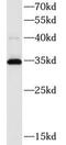 ATP Synthase F1 Subunit Gamma antibody, FNab00704, FineTest, Western Blot image 
