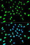 TAR DNA Binding Protein antibody, A01001-1, Boster Biological Technology, Western Blot image 
