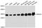 3-Hydroxyisobutyrate Dehydrogenase antibody, STJ23942, St John