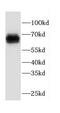 Fc Fragment Of IgA Receptor antibody, FNab01505, FineTest, Western Blot image 