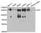 DNA Ligase 1 antibody, MBS127265, MyBioSource, Western Blot image 