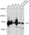 Lymphocyte Cytosolic Protein 1 antibody, GTX33300, GeneTex, Western Blot image 