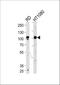 ATPase Sarcoplasmic/Endoplasmic Reticulum Ca2+ Transporting 1 antibody, A04657, Boster Biological Technology, Western Blot image 