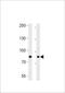 Ubiquitin Specific Peptidase 51 antibody, TA325185, Origene, Western Blot image 