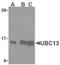 Ubiquitin Conjugating Enzyme E2 N antibody, PA5-20080, Invitrogen Antibodies, Western Blot image 