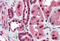DNA Fragmentation Factor Subunit Beta antibody, MBS240363, MyBioSource, Immunohistochemistry paraffin image 
