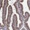 LUC7 Like antibody, NBP2-56401, Novus Biologicals, Immunohistochemistry paraffin image 