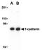 Cadherin 13 antibody, AP05560PU-N, Origene, Western Blot image 