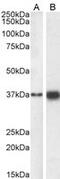 SRY-Box 2 antibody, GTX18149, GeneTex, Western Blot image 