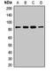 Methylmalonyl-CoA mutase, mitochondrial antibody, orb412228, Biorbyt, Western Blot image 