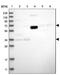 Protein THEMIS2 antibody, NBP1-87848, Novus Biologicals, Western Blot image 