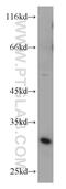 Zinc Finger Matrin-Type 3 antibody, 10504-1-AP, Proteintech Group, Western Blot image 