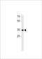 Rhox Homeobox Family Member 2B antibody, TA324664, Origene, Western Blot image 