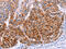 Arylacetamide Deacetylase antibody, CSB-PA834531, Cusabio, Immunohistochemistry paraffin image 