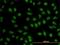 BCL9 Transcription Coactivator antibody, H00000607-M01, Novus Biologicals, Immunofluorescence image 