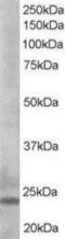 BCL2 Like 11 antibody, NB100-1440, Novus Biologicals, Western Blot image 