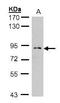 Mannosyl-Oligosaccharide Glucosidase antibody, GTX105798, GeneTex, Western Blot image 