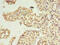 RWD Domain Containing 2A antibody, CSB-PA883450LA01HU, Cusabio, Immunohistochemistry frozen image 