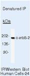 ERBB2 antibody, PA5-16305, Invitrogen Antibodies, Immunoprecipitation image 