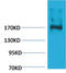 Ectopic P-Granules Autophagy Protein 5 Homolog antibody, STJ97390, St John