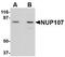 Nucleoporin 107 antibody, TA306612, Origene, Western Blot image 