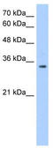 POU Domain Class 5, Transcription Factor 2 antibody, TA345573, Origene, Western Blot image 