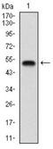 Gamma-Aminobutyric Acid Type B Receptor Subunit 2 antibody, NBP2-37281, Novus Biologicals, Western Blot image 