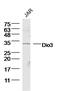 Iodothyronine Deiodinase 3 antibody, GTX60156, GeneTex, Western Blot image 