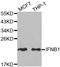 Interferon Beta 1 antibody, TA332409, Origene, Western Blot image 