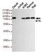 Bruton Tyrosine Kinase antibody, TA346898, Origene, Western Blot image 