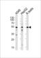 Activin A Receptor Type 1 antibody, LS-C98079, Lifespan Biosciences, Western Blot image 