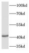 Tyrosylprotein Sulfotransferase 2 antibody, FNab08906, FineTest, Western Blot image 