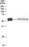 Protein Phosphatase 2 Regulatory Subunit B'Beta antibody, NB100-850, Novus Biologicals, Western Blot image 