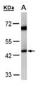 Acyl-CoA Dehydrogenase Medium Chain antibody, NBP1-31397, Novus Biologicals, Western Blot image 