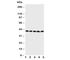 Branched Chain Amino Acid Transaminase 2 antibody, R30575, NSJ Bioreagents, Western Blot image 