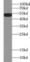 Zinc finger FYVE domain-containing protein 19 antibody, FNab09629, FineTest, Western Blot image 