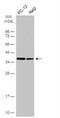Chromosome 9 Open Reading Frame 78 antibody, NBP1-32518, Novus Biologicals, Western Blot image 