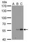 Carbonic Anhydrase 9 antibody, GTX629820, GeneTex, Western Blot image 