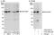 Synoviolin 1 antibody, A302-946A, Bethyl Labs, Immunoprecipitation image 