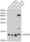 NADH dehydrogenase [ubiquinone] iron-sulfur protein 6, mitochondrial antibody, GTX32743, GeneTex, Western Blot image 