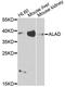 Aminolevulinate Dehydratase antibody, A12395, ABclonal Technology, Western Blot image 